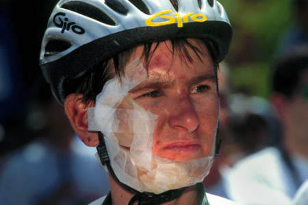 A rider shows the effects of a crash at the 1998 race.